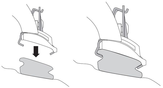 Монтажный комплект Thule 4006 для Volvo XC60 (mkI) 2008-2017 670:500 - Фото 2